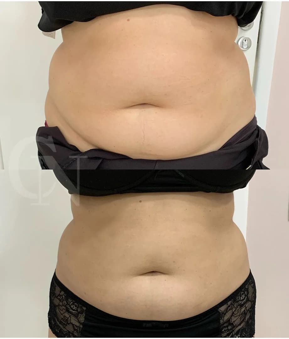 Estética Avançada Carine Nogueira