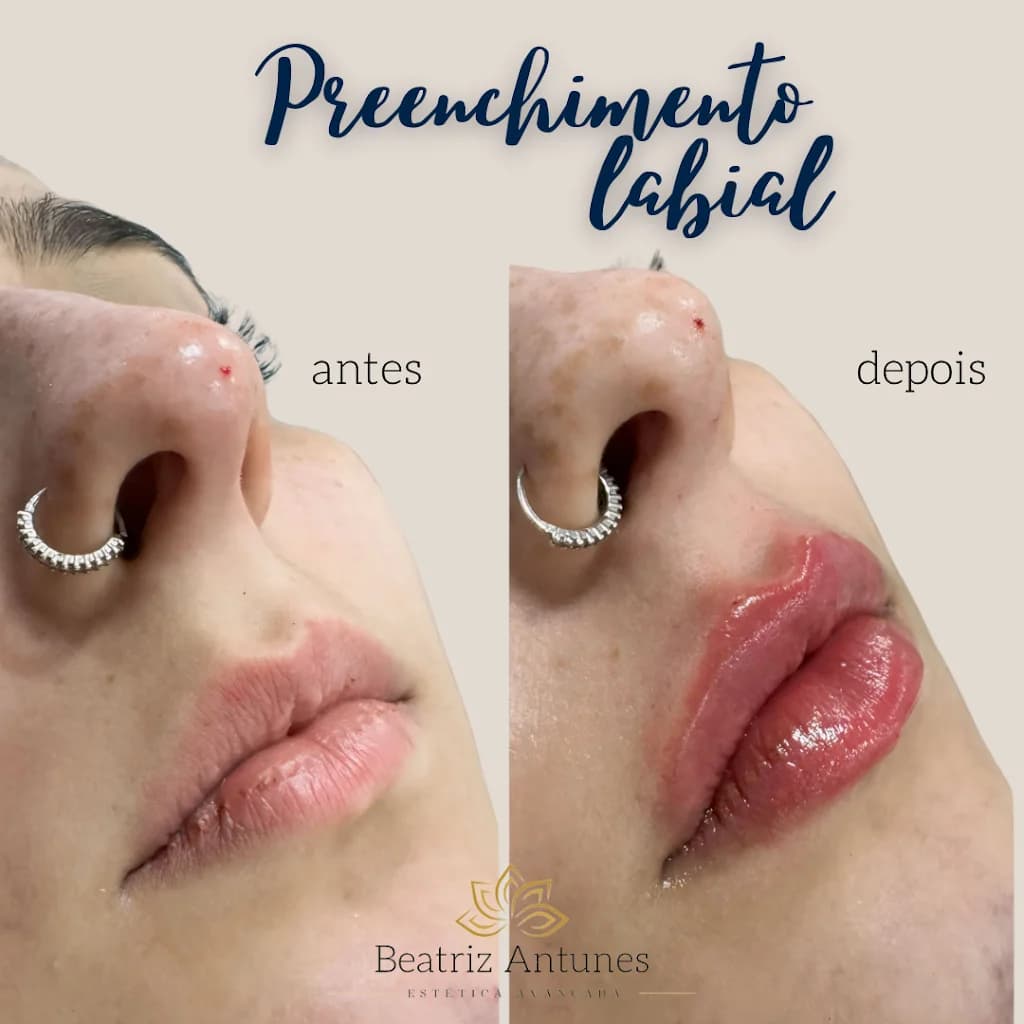 Dra. Beatriz Antunes - Estética avançada – foto 2