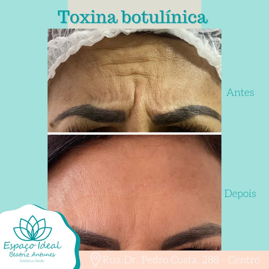 Dra. Beatriz Antunes - Estética avançada – foto 3