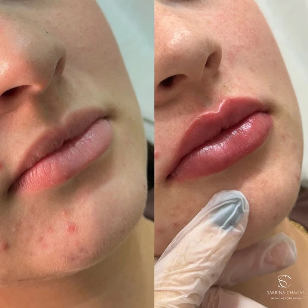 Dra. Sabrina Chagas - Harmonização Facial