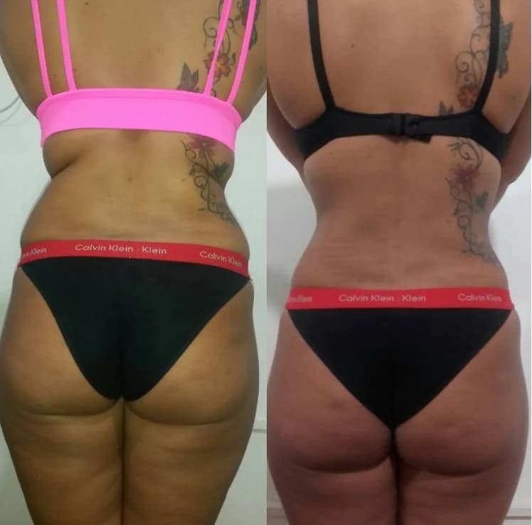 Clínica de Estética Corpo & Mente