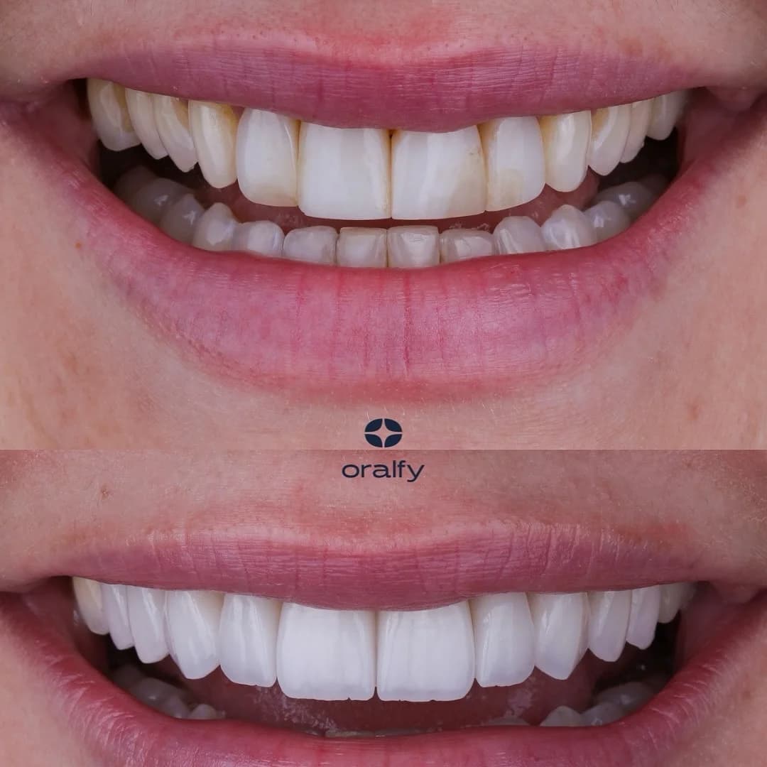 Oralfy Belém | Implante | Invisalign | Dentista em Belém – foto 3