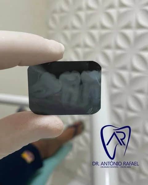 Consultório Odontológico Dr. Antônio Rafael | Implante Dentário | Facetas | Clareamento Dental | Ananindeua – foto 3