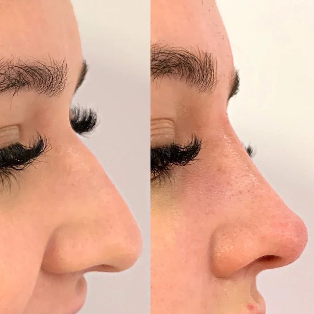 Dra. Isabela Belló - Harmonização Facial – foto 2