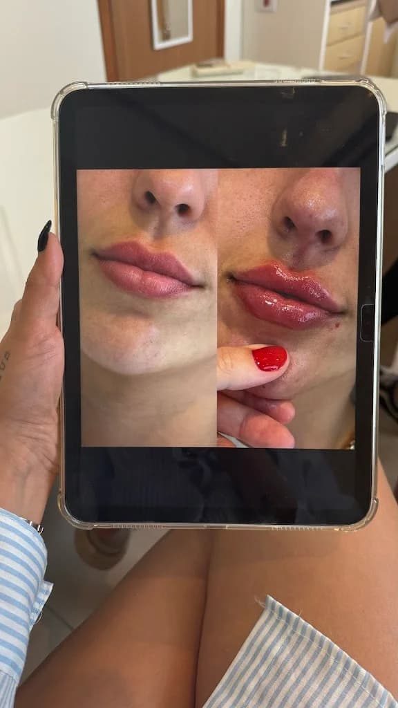 Dra. Isabela Belló - Harmonização Facial – foto 3