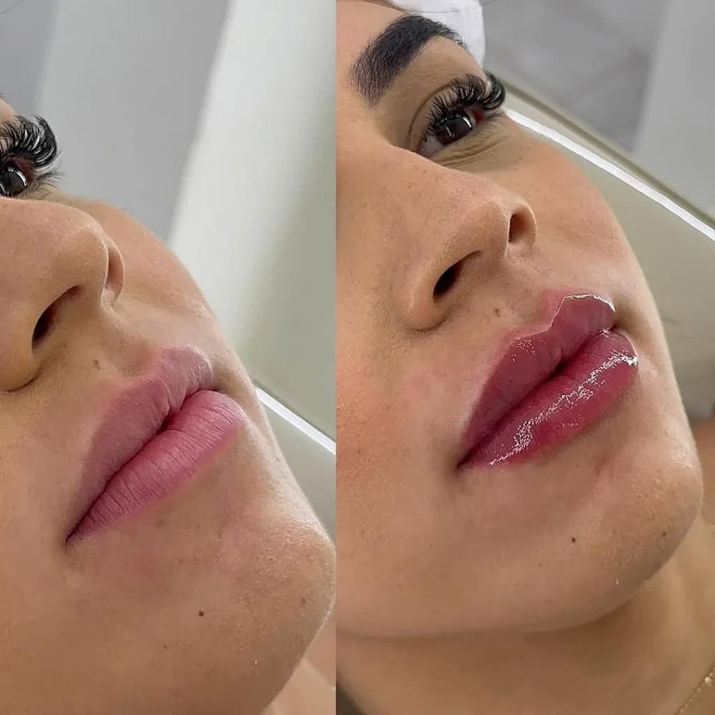 Doutora Esteta | Harmonização Facial