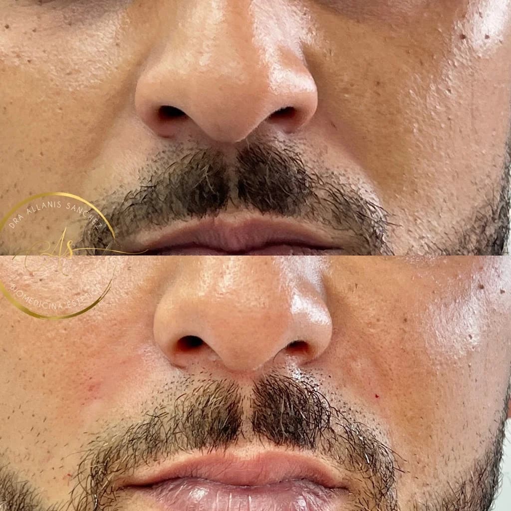Dra. Allanis Sanchez - Harmonização Facial – foto 1