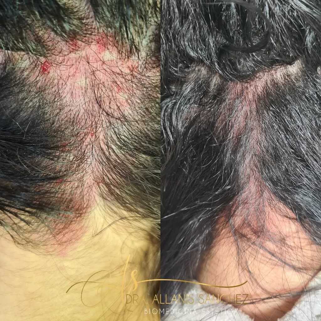 Dra. Allanis Sanchez - Harmonização Facial