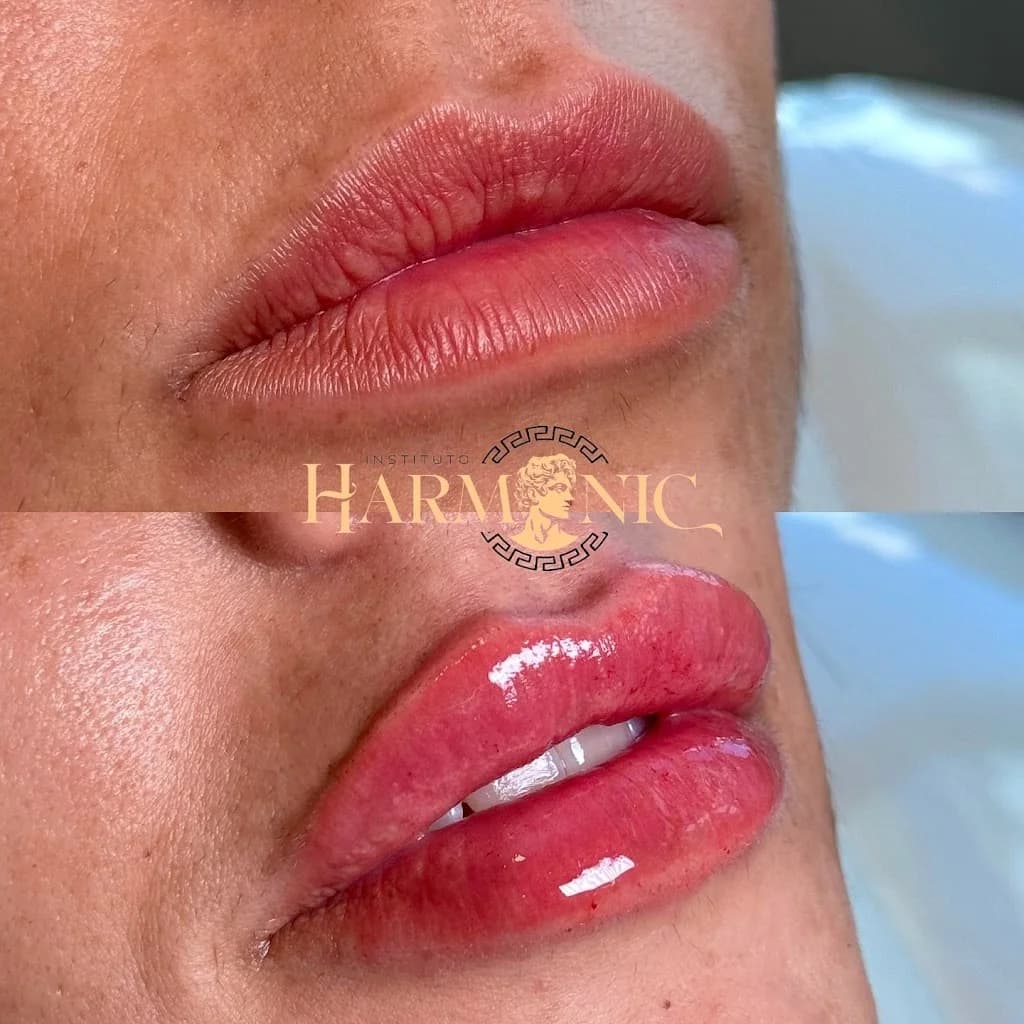 Clínica de Estética em Vila Velha | Instituto Harmonic | Harmonização Facial – foto 2