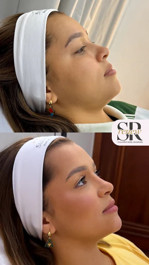Clínica Suzyanne Raissa Harmonização Facial & Corporal – foto 3