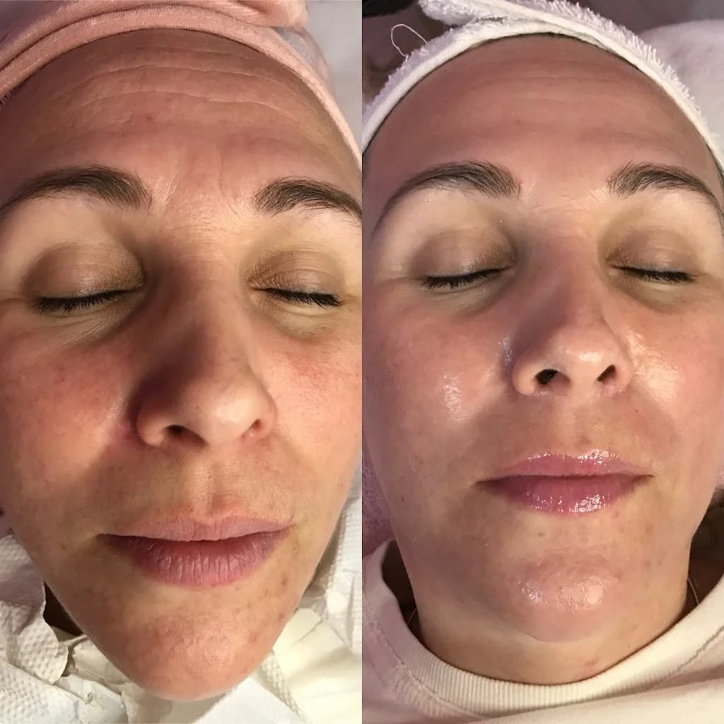 Estética avançada - Naiane Freitas – foto 1