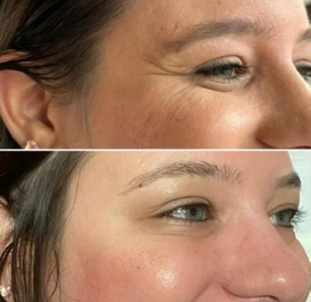 ReFace Harmonização e Estética Facial