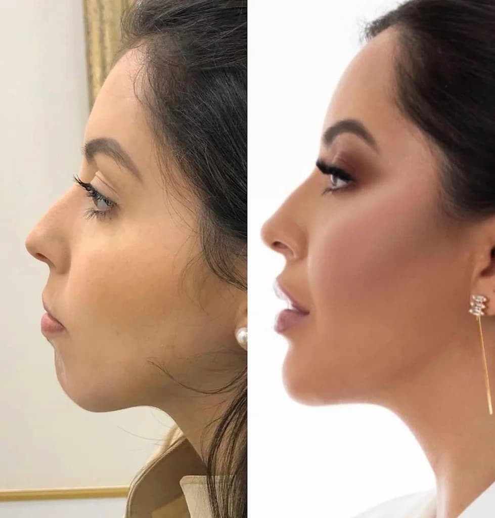 ReFace Harmonização e Estética Facial – foto 2