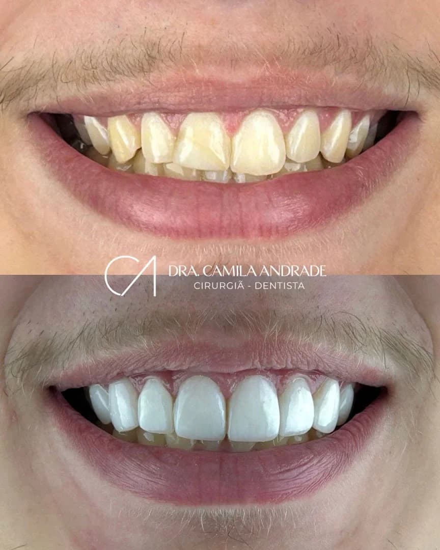 Dentista em Salvador | Dra. Camila Andrade