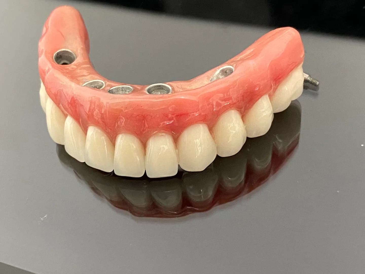 Clínica EquipeDente | Invisalign | Implante Dentário | Nazaré | Belém - PA – foto 3