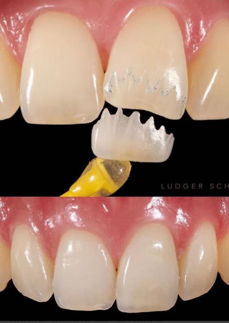 DENTISTA NITERÓI - Dr. Wanderson Lugão Clínica CEIO - centro especializado em implantes e ortodontia – foto 3