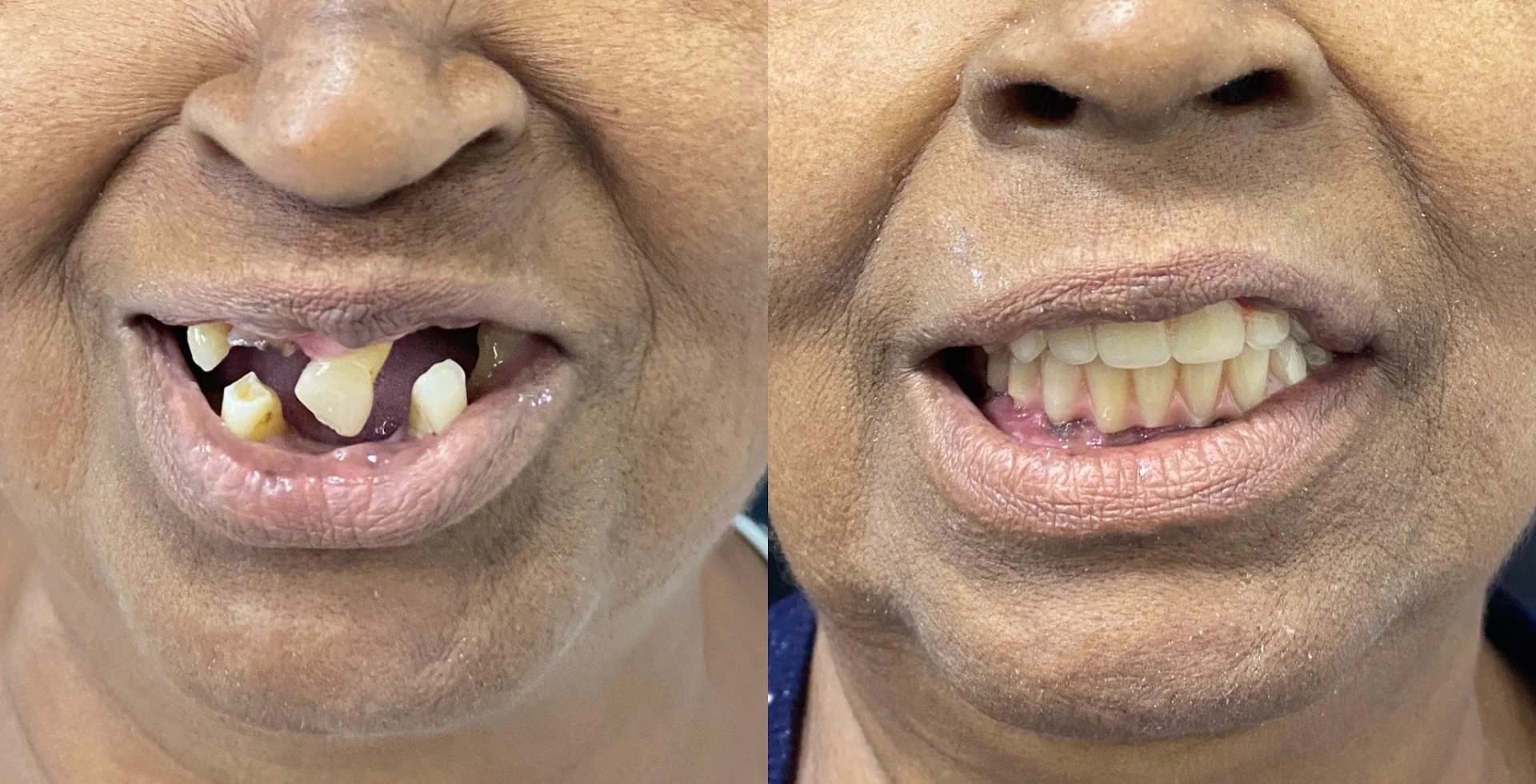 DENTISTA NITERÓI - Dr. Wanderson Lugão Clínica CEIO - centro especializado em implantes e ortodontia