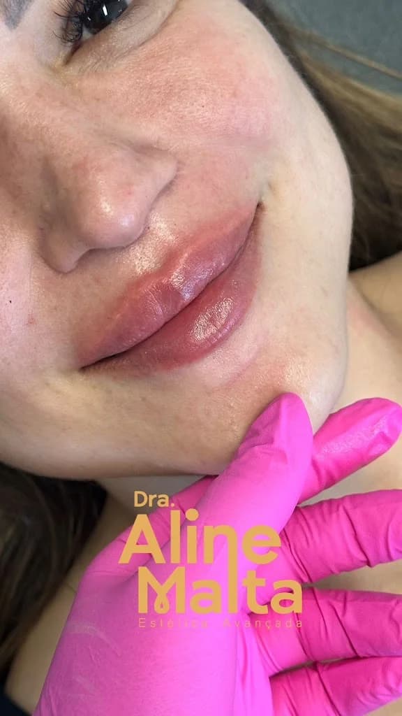Dra. Aline Malta - Estética Avançada – foto 2