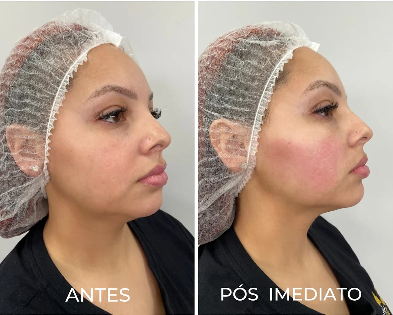 Royal Face Clínica de Estética - Sete Lagoas – foto 2