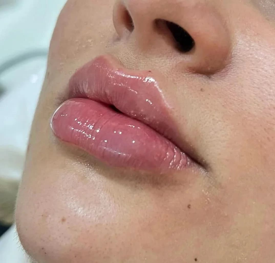 Clínica Drª Taynara Xavier Harmonização Facial & Corporal – foto 2