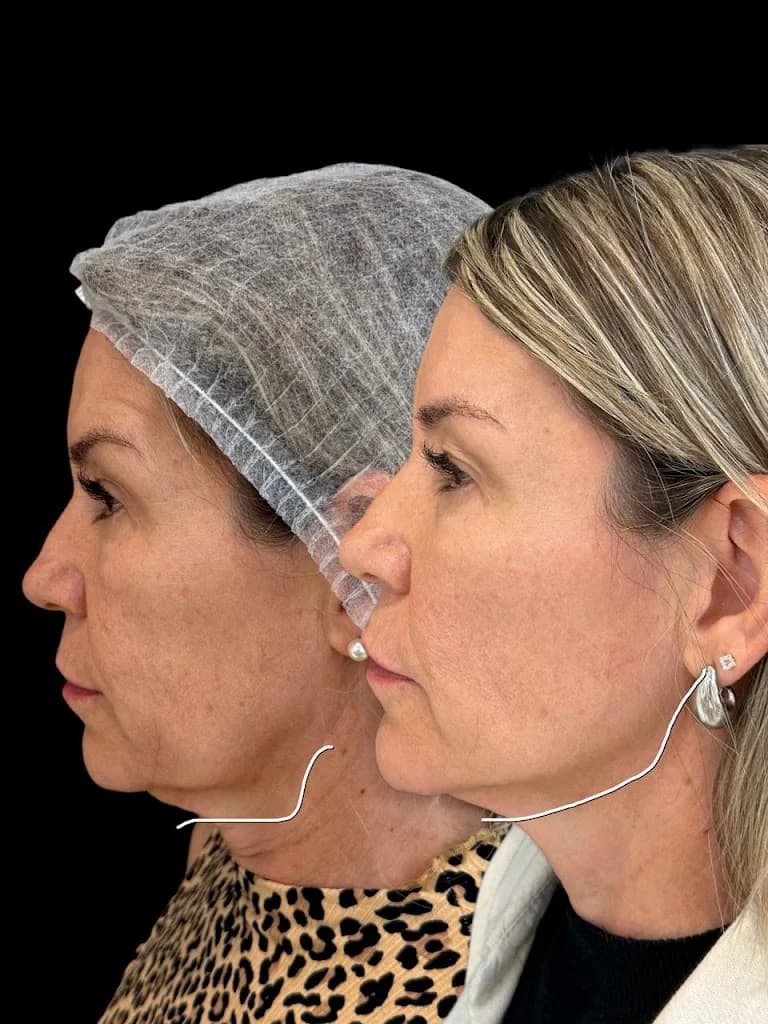 Dra. Giulliana Melazzo - Harmonização Facial em Anápolis - GO
