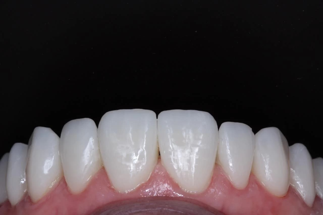 COPAN | Centro Odontológico Parque das Nações INVISALIGN |IMPLANTES | PROTOCOLO | FACETAS | HARMONIZAÇÃO FACIAL| – foto 3