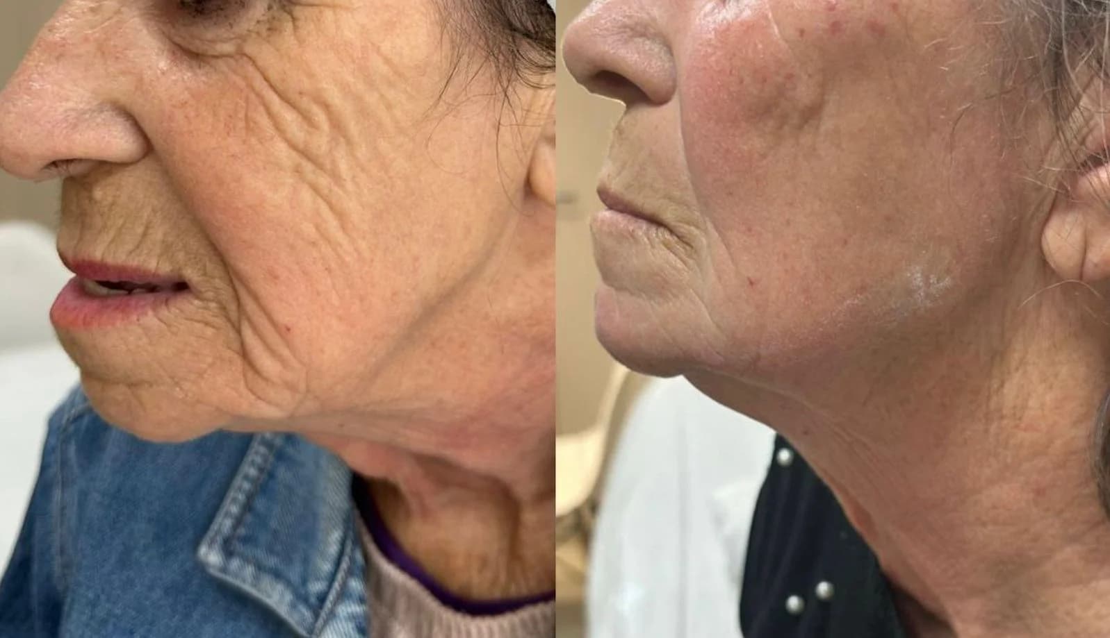 HB Estética Avançada – foto 3