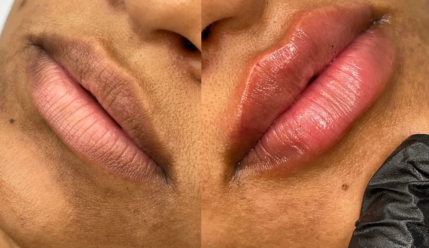 Dra Aline Viana Estética Avançada e Integrativa – foto 3