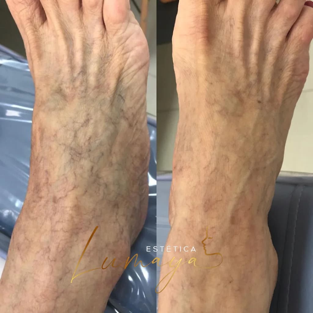 Estética Lumaya – foto 3