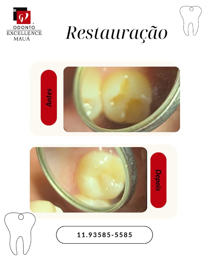 Odonto Excellence Mauá
