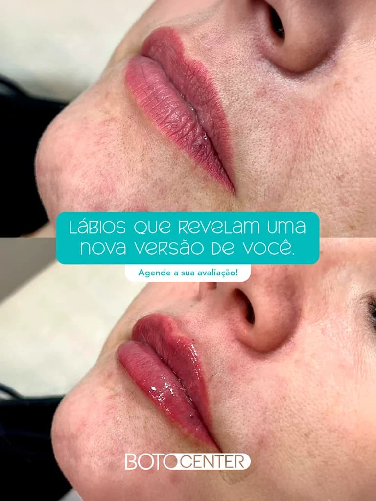 Botocenter Ponta Verde: Clínica de Estética, Maceió AL – foto 2