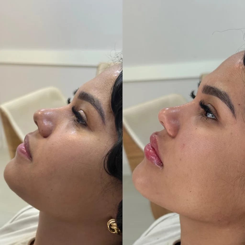 Botocenter Ponta Verde: Clínica de Estética, Maceió AL