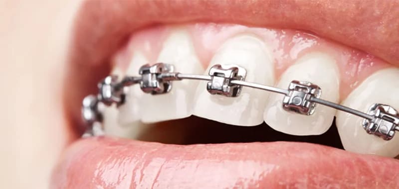 Dentista Nova Lima - Ortho 3D – foto 1