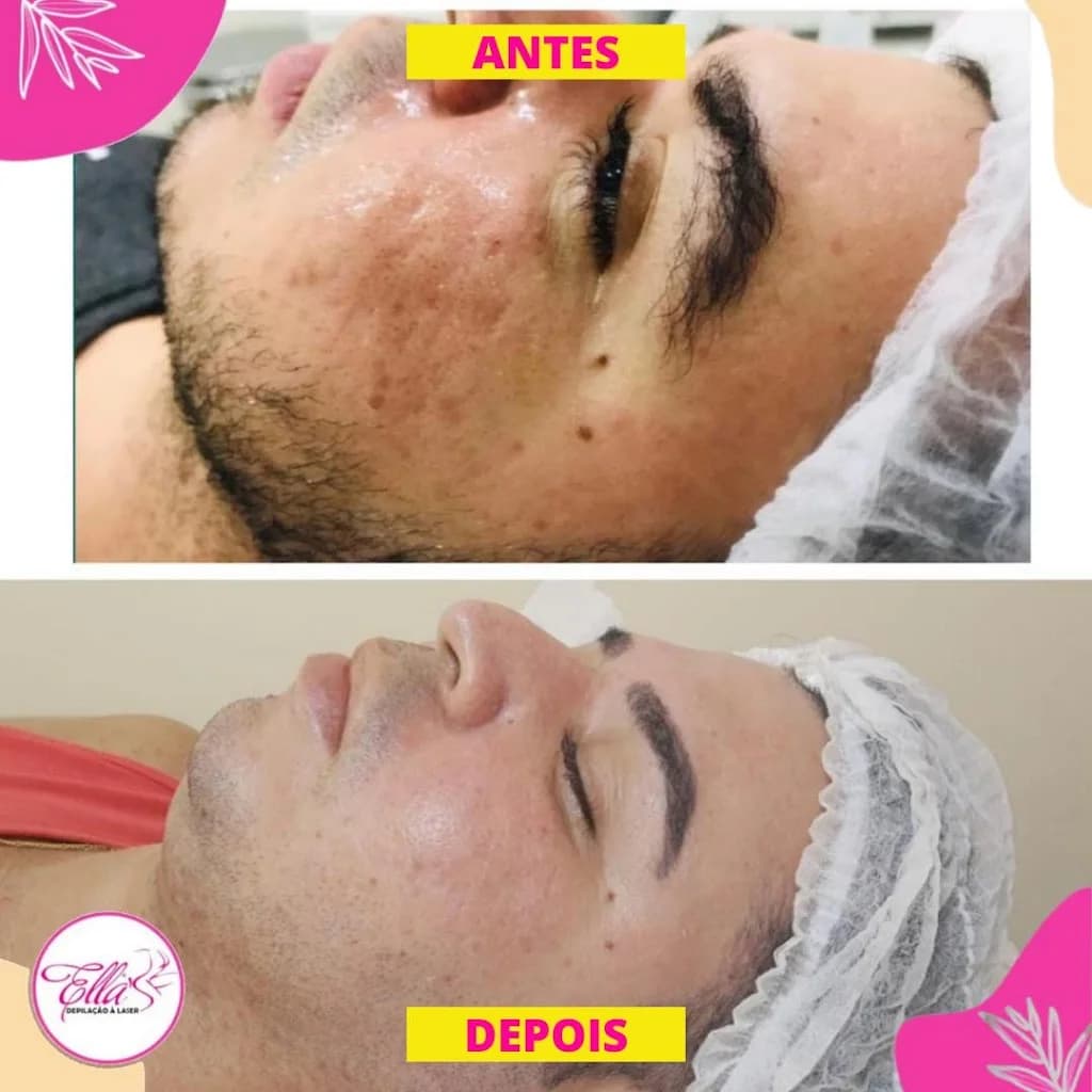 Clínica Ella's Estética e Depilação a Laser – foto 2