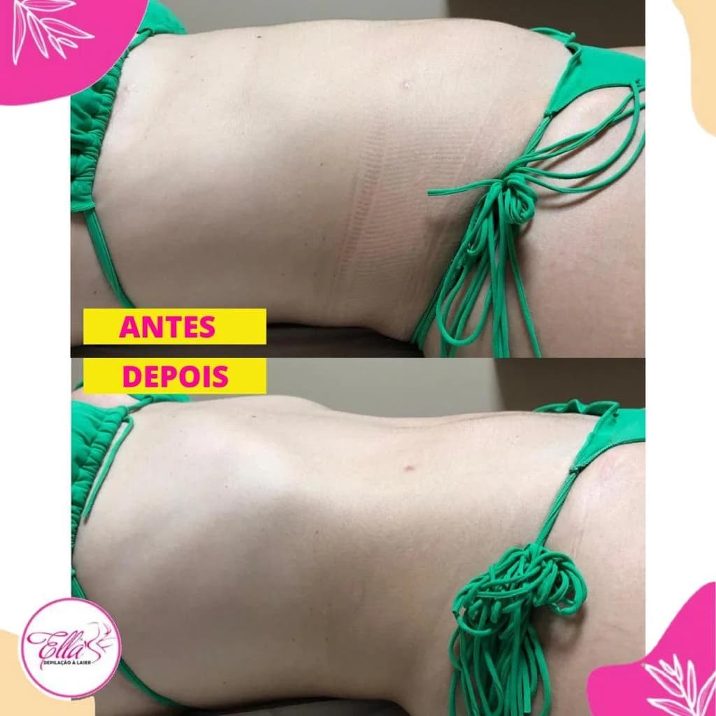 Clínica Ella's Estética e Depilação a Laser – foto 3