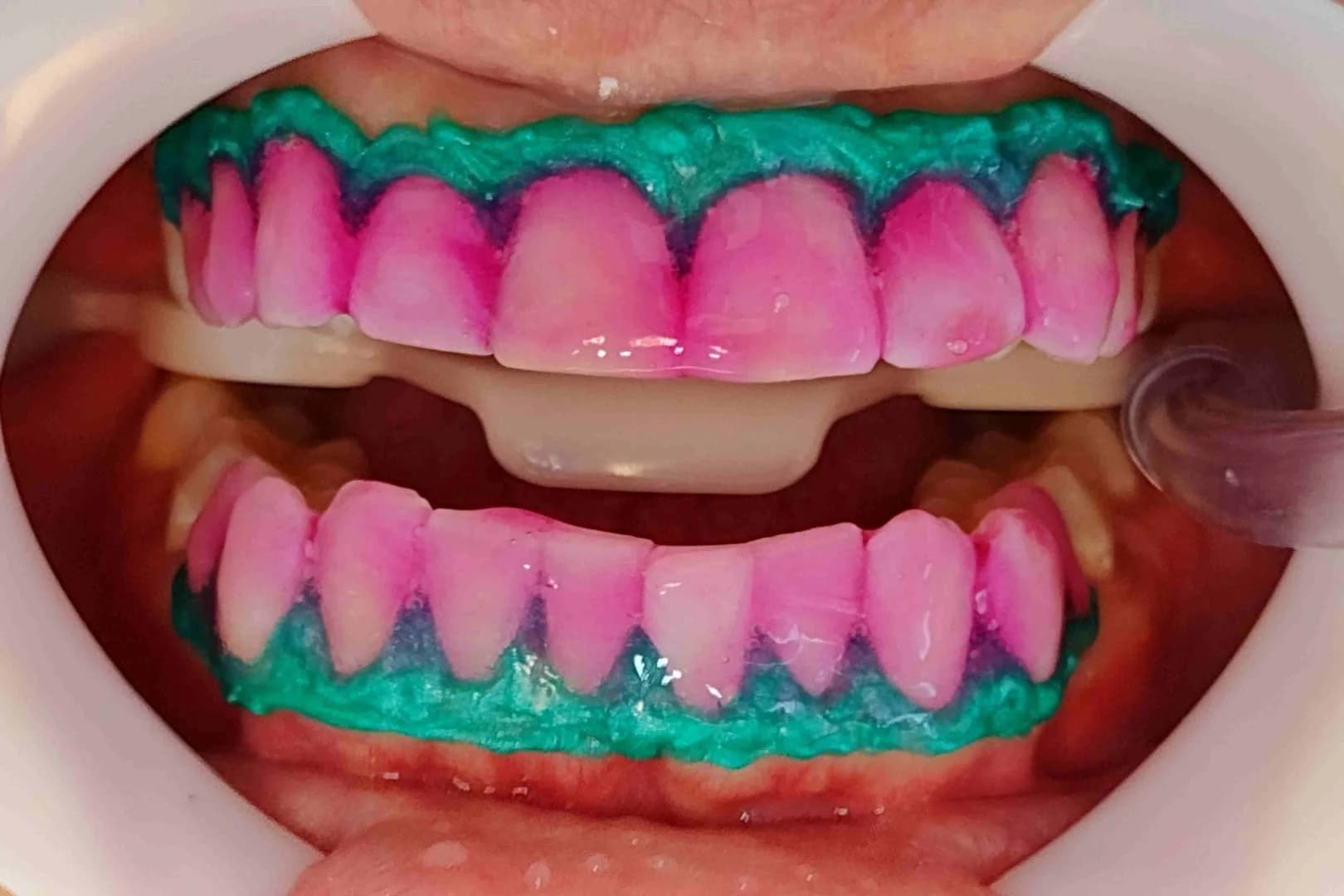 Dra Amanda Carvalho Cirurgiã-Dentista – foto 2