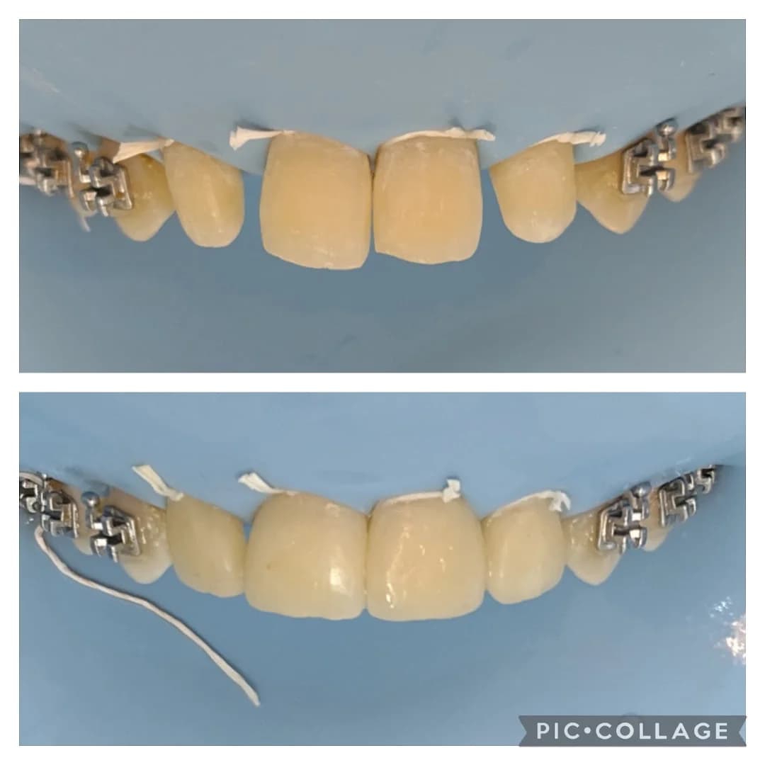 Dra Amanda Carvalho Cirurgiã-Dentista