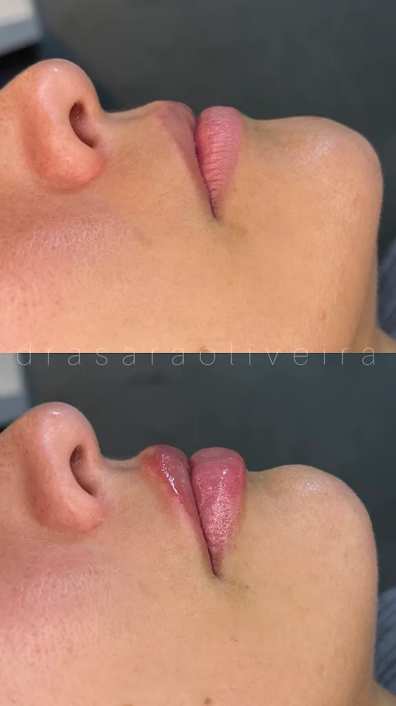 Dra Sara Oliveira Harmonização Facial em Salvador – foto 3