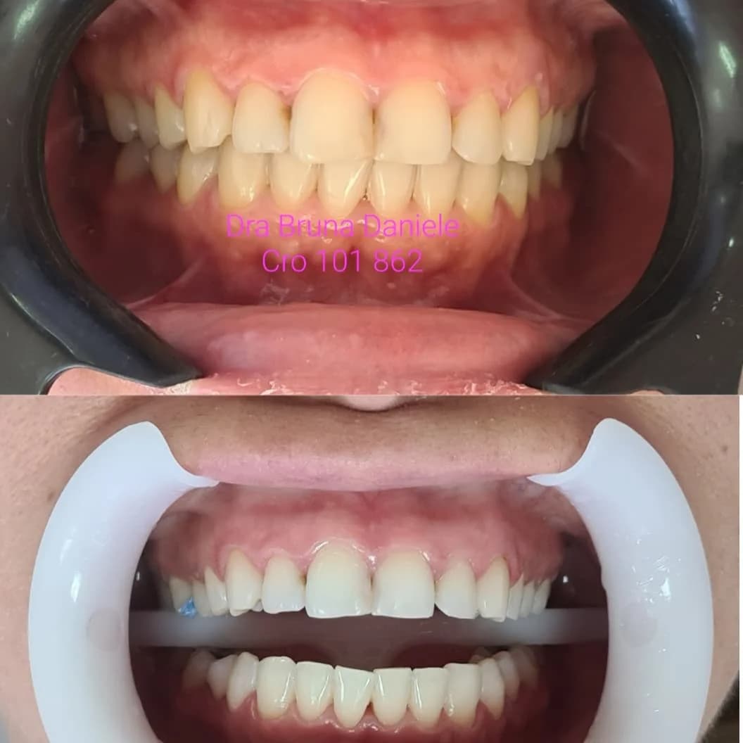 Dentista - Dra Bruna Daniele / Ortodontista em Santo André - Parque das Nações – foto 2