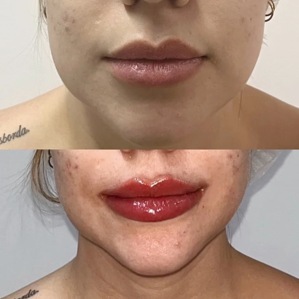 Dra Dayana Ferreira - Harmonização Facial • Laser Pisom - Centro Rio de Janeiro