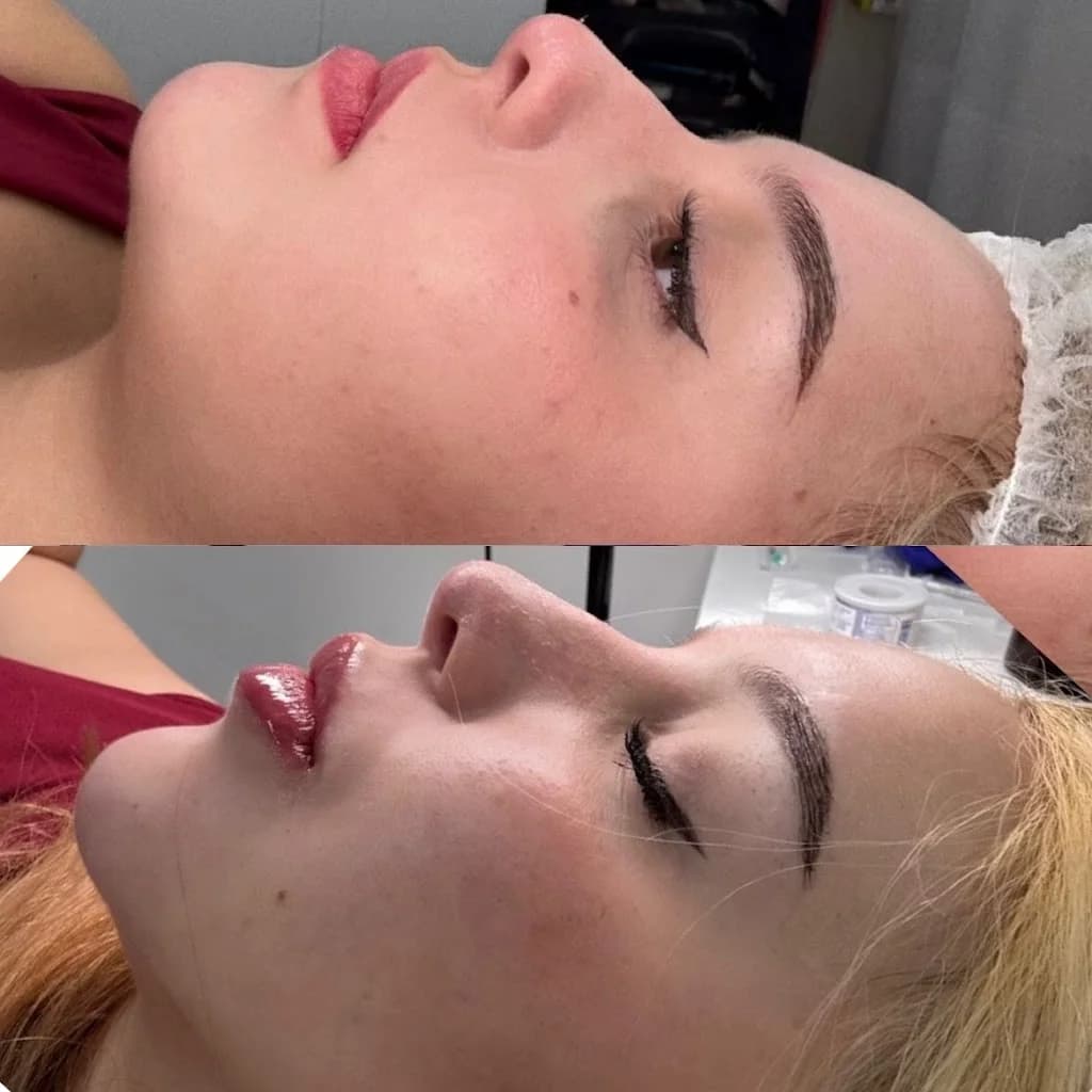 Dra Dayana Ferreira - Harmonização Facial • Laser Pisom - Centro Rio de Janeiro – foto 2