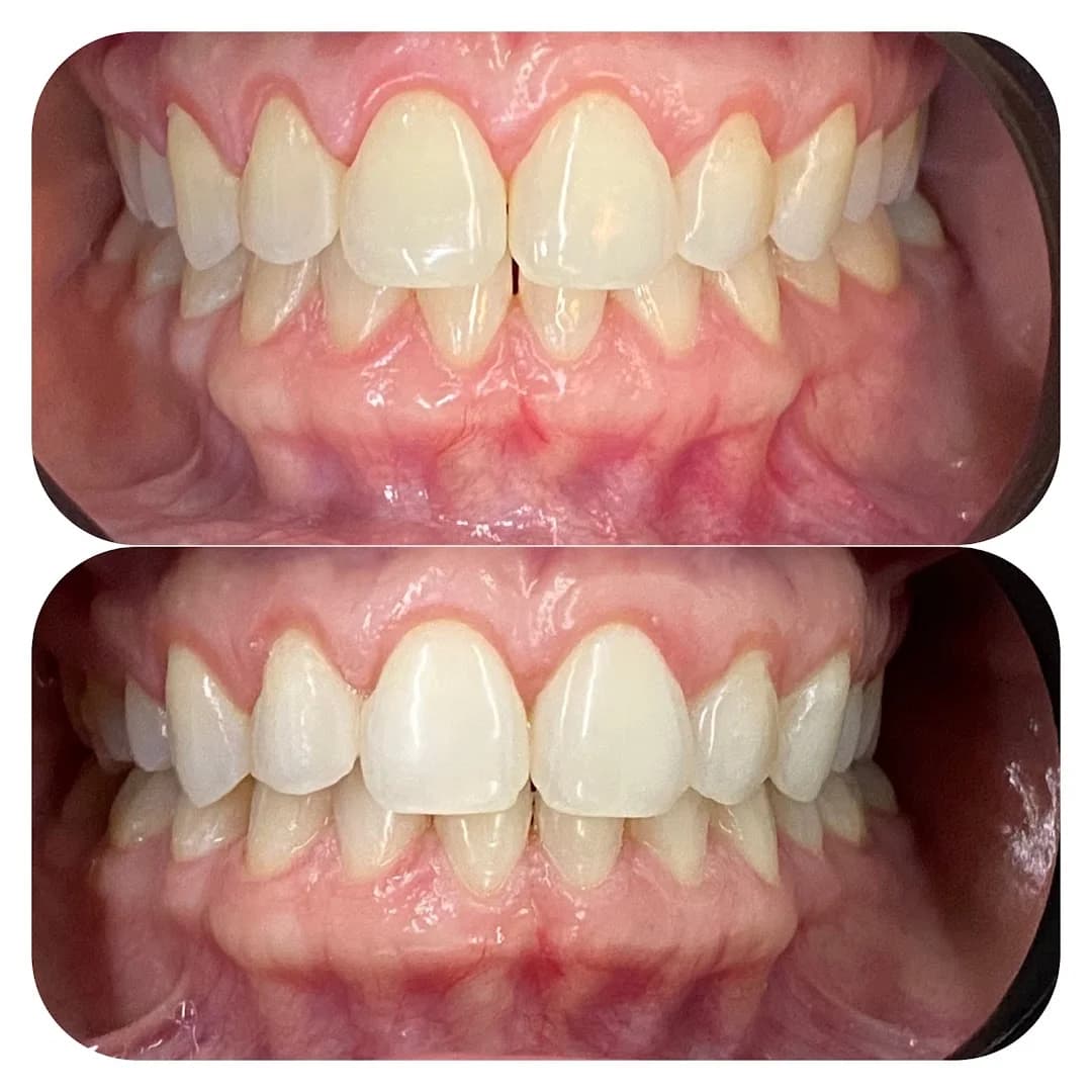 Dra. Mairaira Leão (Periodontista e Implantodontista). – foto 3