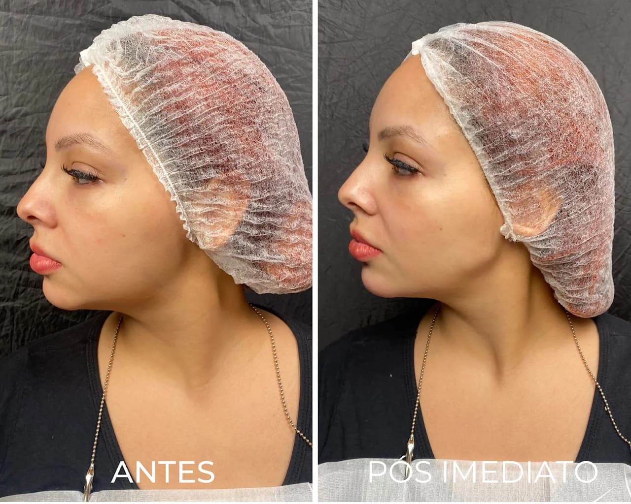 Royal Face Clínica de Estética - Campos dos Goytacazes