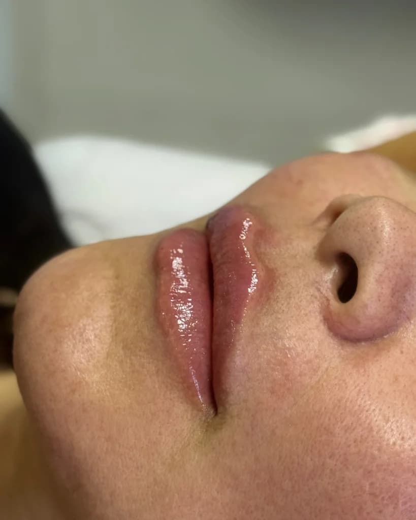 Dra. Silvia Neves - Estética Avançada – foto 3
