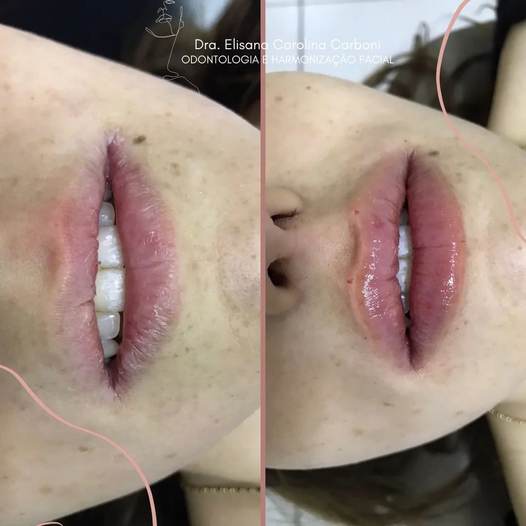Specialité Odontologia Avançada e Harmonização Orofacial – foto 3