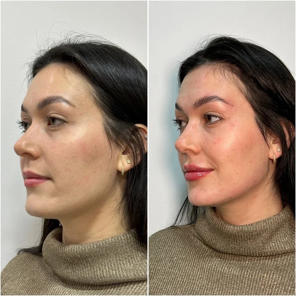 Clínica Dra Gabriela Sofia - Harmonização Facial e Corporal – foto 3