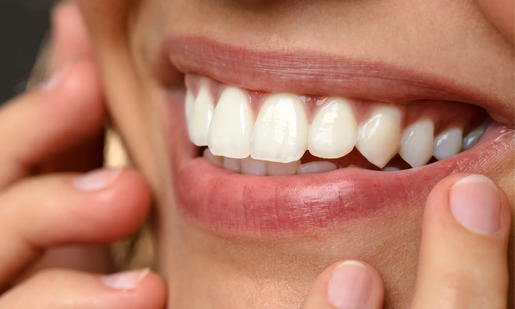 Top Estética Bucal - Clínica Odontológica | Dentista em Caxias do Sul | Aparelhos Ortodônticos | Implantes Dentários – foto 1