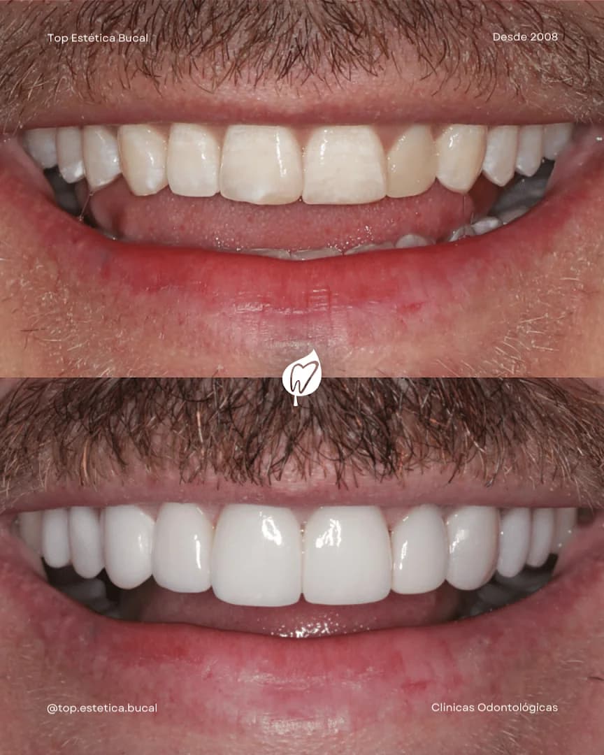 Top Estética Bucal - Clínica Odontológica | Dentista em Caxias do Sul | Aparelhos Ortodônticos | Implantes Dentários – foto 3