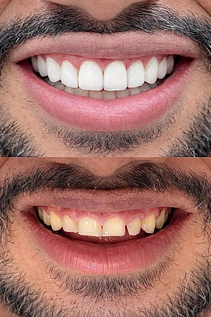 Dentista em Cuiabá - Dra Mariana Lima Pereira – foto 3