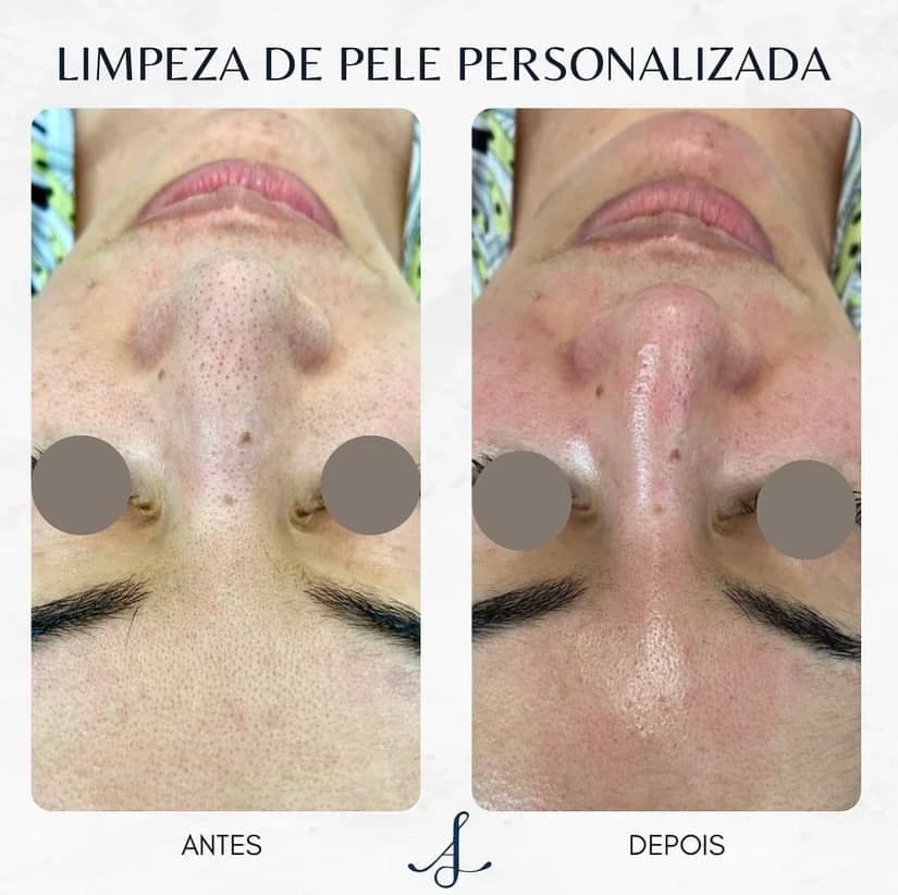 Clínica Ana Letícia Alves - Estética Avançada Facial